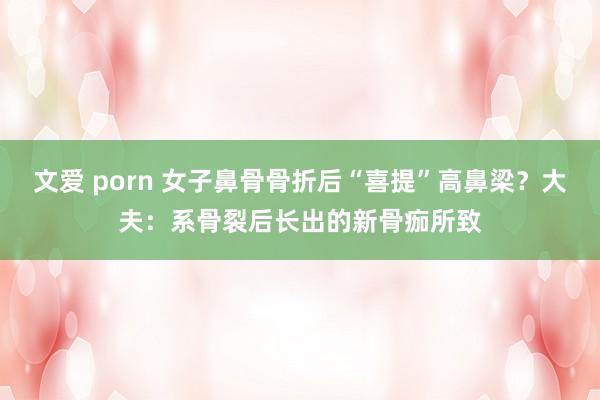 文爱 porn 女子鼻骨骨折后“喜提”高鼻梁？大夫：系骨裂后长出的新骨痂所致
